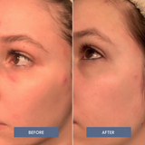 Easy on the Eyes Calming Face Mist with Hypochlorous Acid