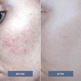 Easy on the Eyes Calming Face Mist with Hypochlorous Acid