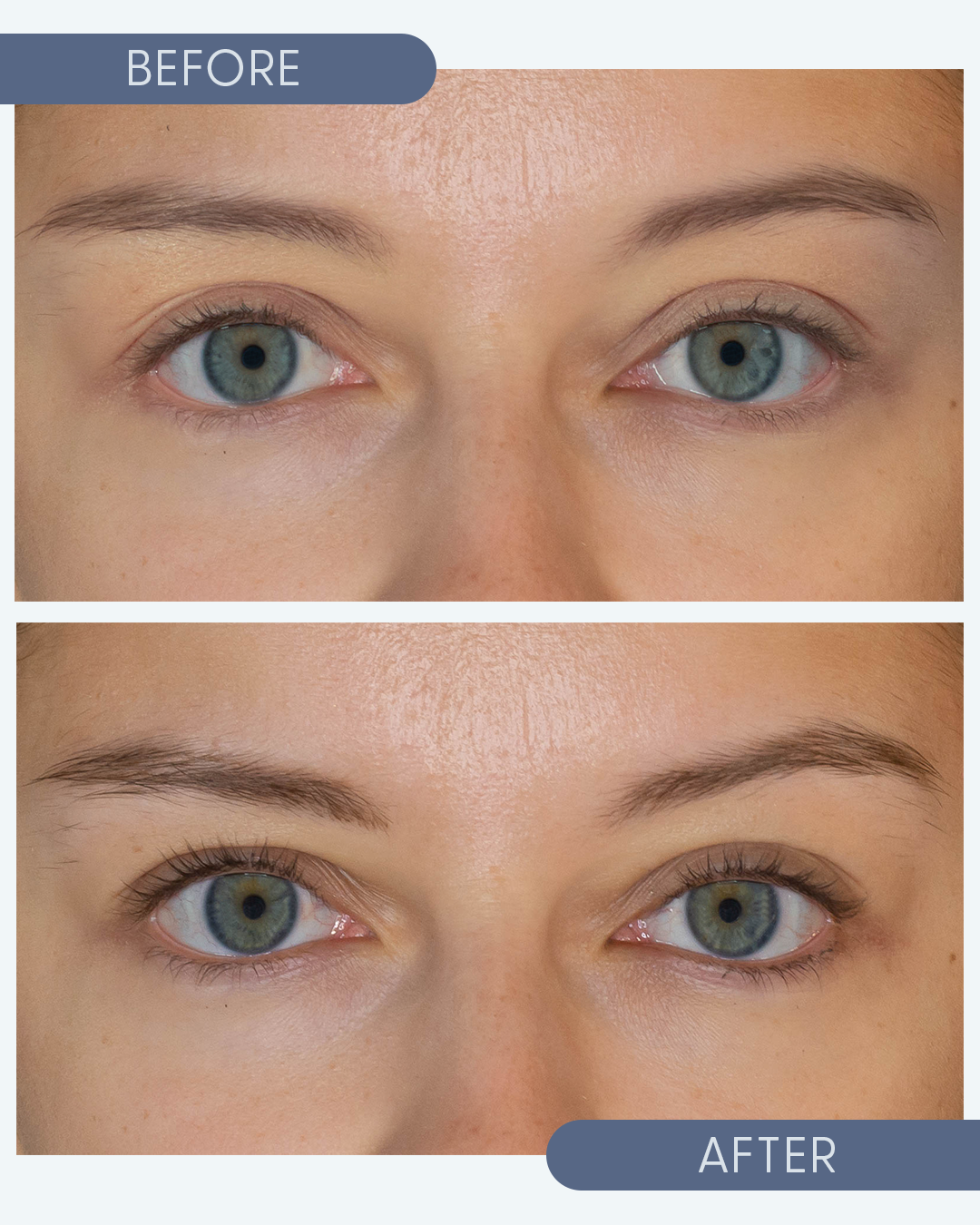 Before and after results from eyebrow & lash serum show longer, fuller eye lashes and soothed dry eyes