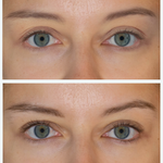 Before and after results from eyebrow & lash serum show longer, fuller eye lashes and soothed dry eyes