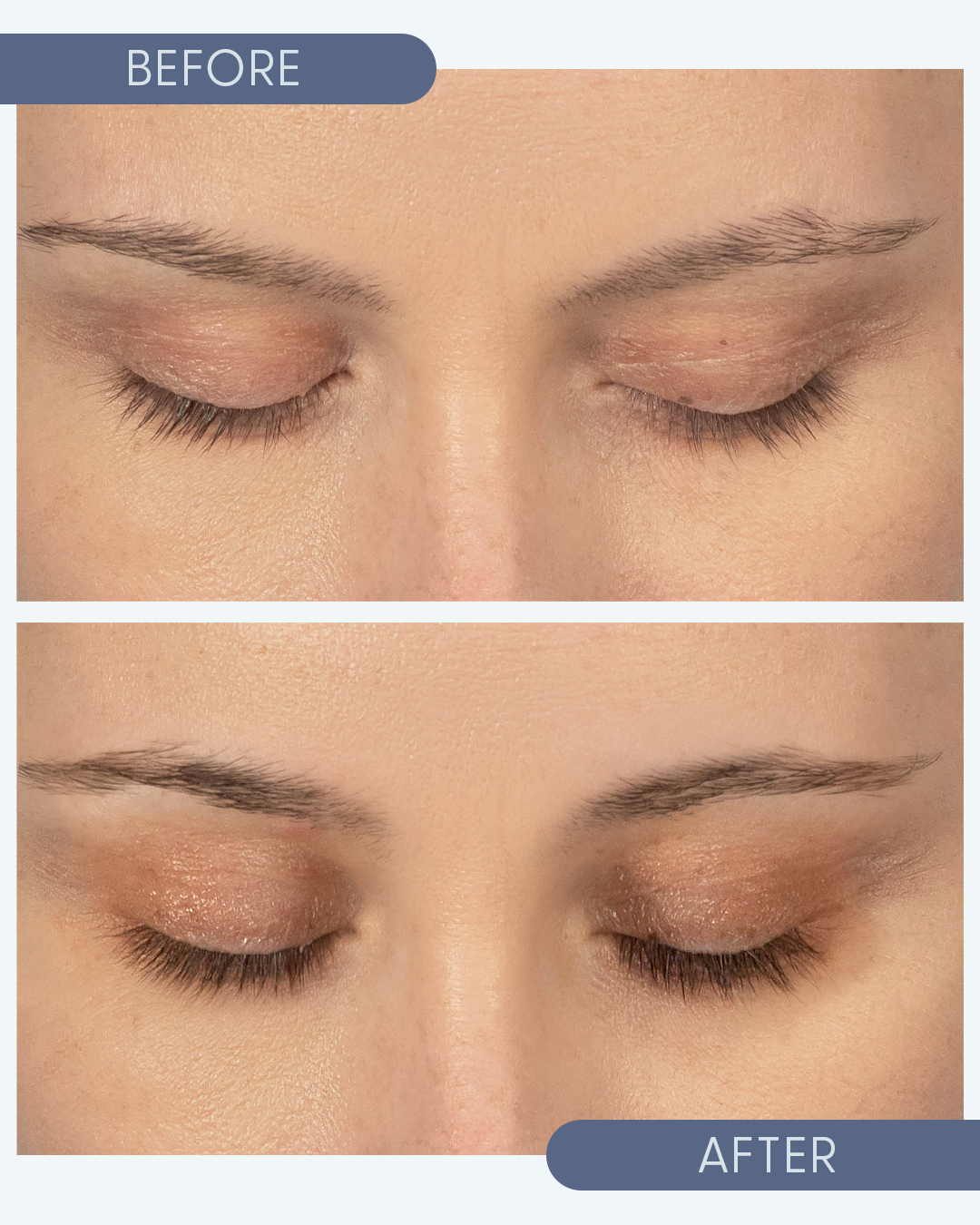 Before and after results within 3 months deliver longer, thicker lashes