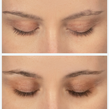 Before and after results within 3 months deliver longer, thicker lashes
