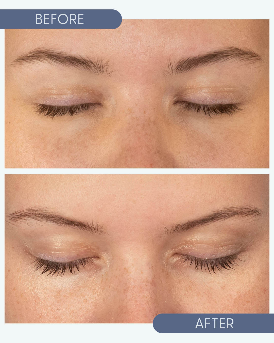 Before and after image features lash serum that conditions and nourishes with castor oil, argan oil and coconut oil